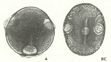 Горошек мышиный (Vicia cracca L)-пыльцевые зерна Горошек мышиный (Vicia cracca L)-пыльцевые зерна